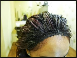 How to remove hair dye from face How do you get hair dye off your face