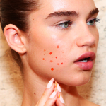 Smelly Pores on Face